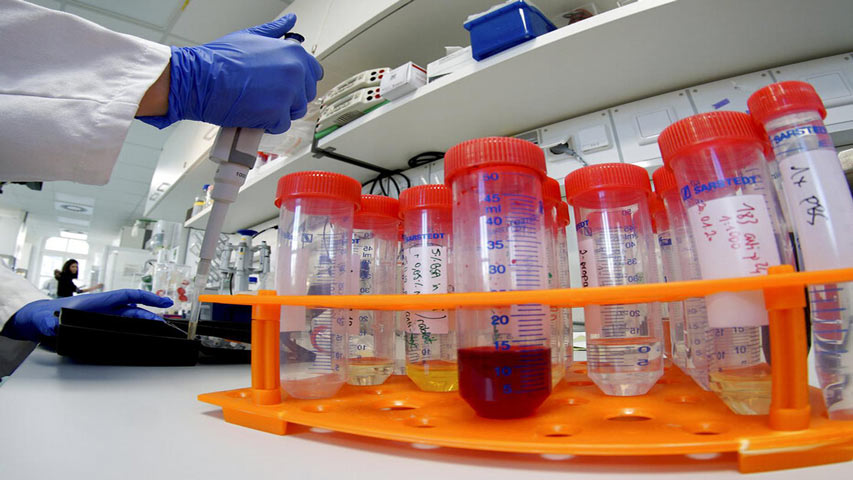 Ecuador ya cuenta con reactivos para detectar casos de coronavirus